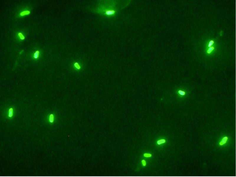 Células al microscopio (inmunofluorescencia indirecta)